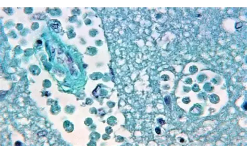 ‘Brain-Eating Amoeba’ Outbreak Claims 19 Lives in 2025