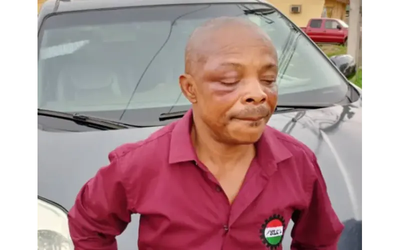 Alleged Attack: NLC President, Ajaero Narrates His Ordeal 