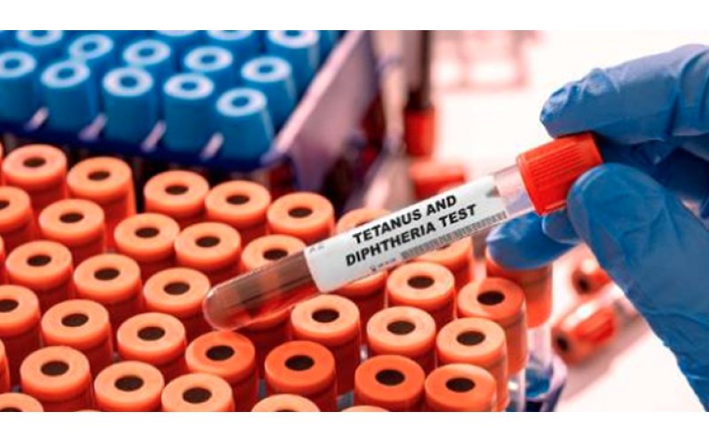 Katsina Records Over 1,000 Diphtheria Cases Since January, Intensifies Response