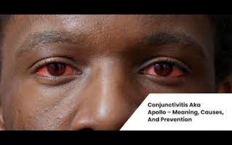 Viral conjunctivitis outbreak in northern Malawi
