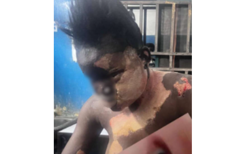 Kano Woman Burns Colleague in Boiling Water Attack